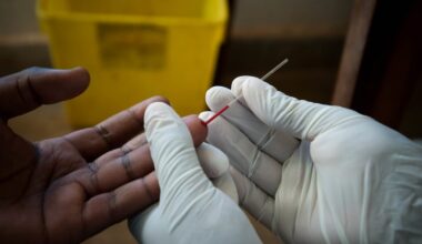 Younger, mobile men especially likely to not know they have HIV in eastern and southern Africa