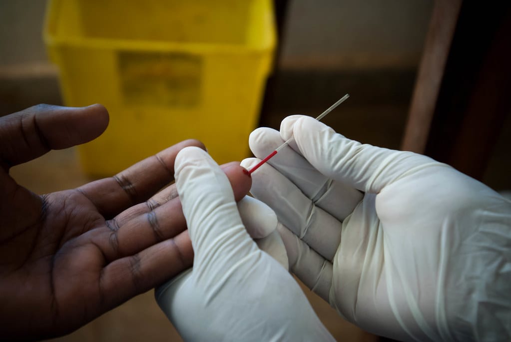 Younger, mobile men especially likely to not know they have HIV in eastern and southern Africa