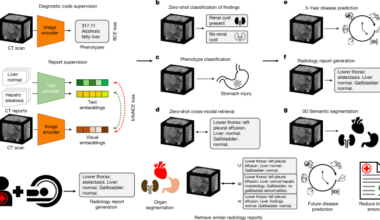 Merlin: a computed tomography vision–language foundation model and dataset