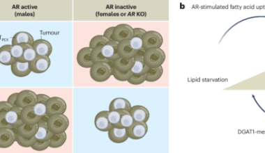 Fat chance of male and female equality in tumour immunity