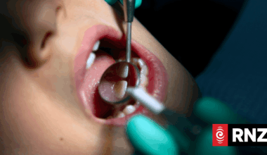 Free dental care receives widespread support in new survey