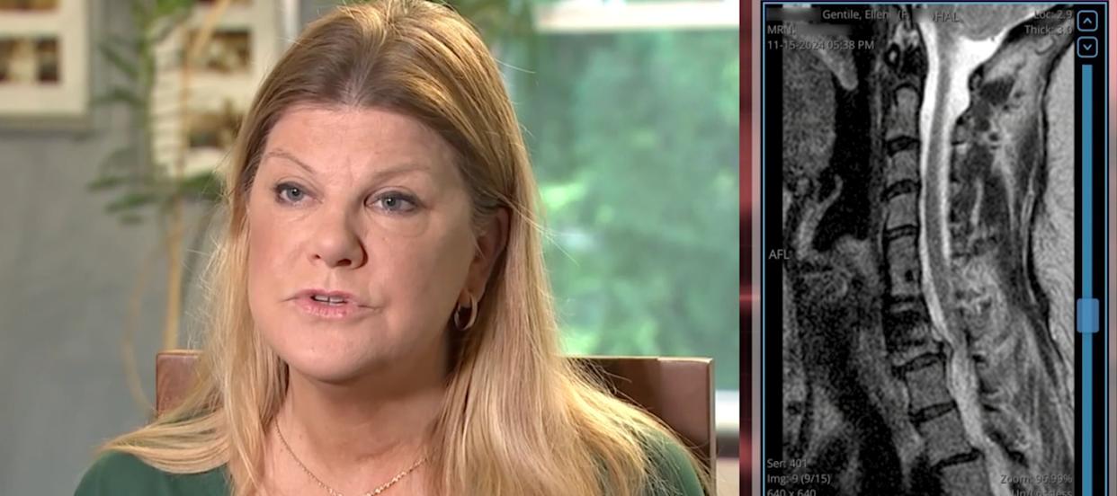 Woman being interviewed and image of a catscan