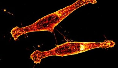 FAU Discovery of Tiny Cell ‘Tunnels’ Finds New Path to Slow Huntington’s Disease