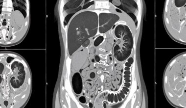 Rising CT Scans in Elderly Raise Radiation Questions – EMJ