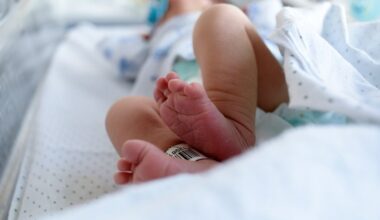 Sugar Helps Relieve Pain in Newborns During Venepuncture