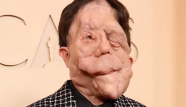 Actor Adam Pearson hits back at comedian’s cruel tweet about him