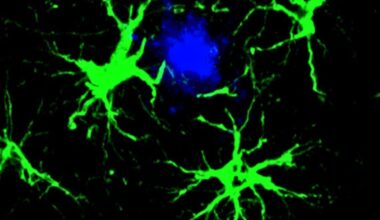 Scientists Cut Amyloid Plaques by 50% in Mice With Engineered Cells : ScienceAlert