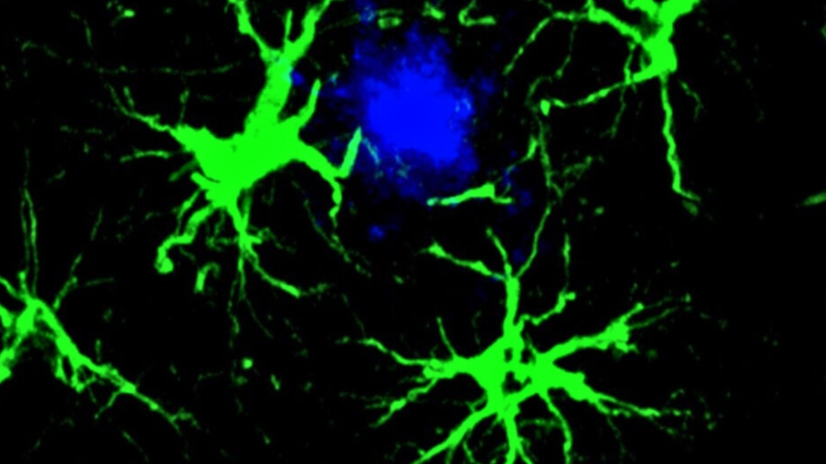 Scientists Cut Amyloid Plaques by 50% in Mice With Engineered Cells : ScienceAlert