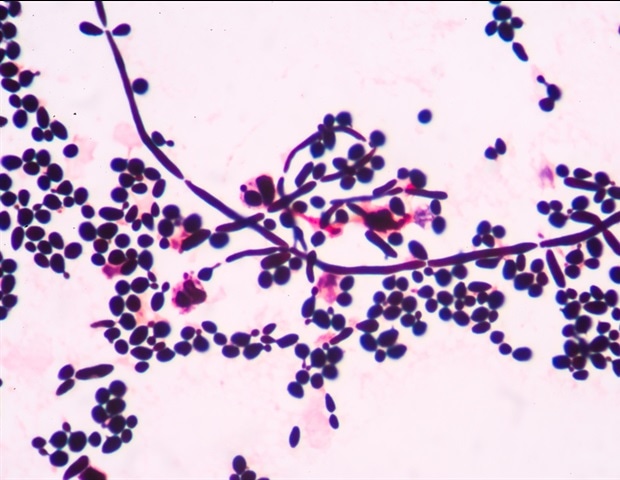 New catalog identifies dozens of plasma membrane repair proteins