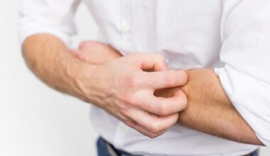 Math-based model helps optimize treatment for chronic eczema