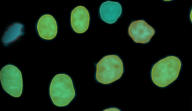 Imaris 11 transforms image analysis