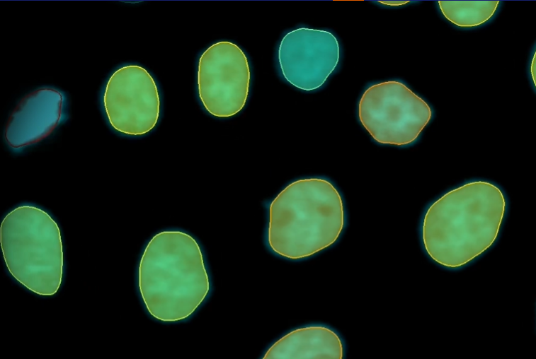 Imaris 11 transforms image analysis