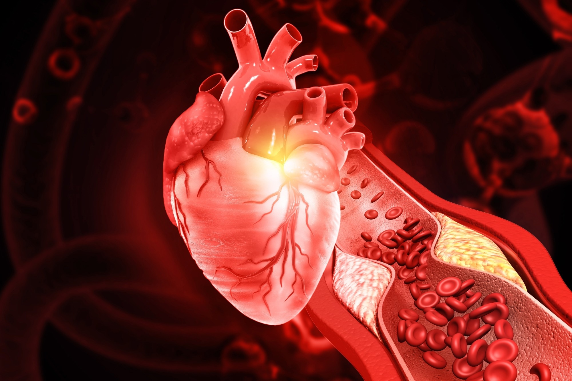 Study: Circulating gut microbial metabolites and risk of coronary heart disease: A prospective multi-stage metabolomics study. Image Credit: Explode / Shutterstock