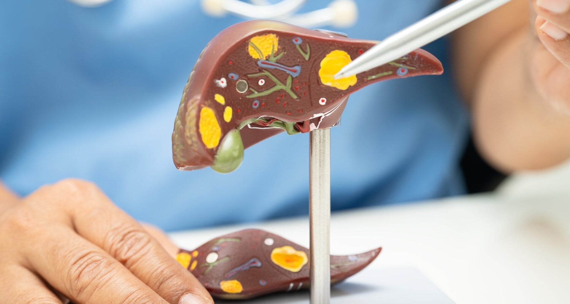 Study: Palmatine ameliorates MASLD in type 2 diabetes by modulating hepatic apoptosis and inflammation. Image Credit: sasirin pamai / Shutterstock