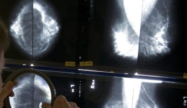 Aging population fuels healthcare services growth