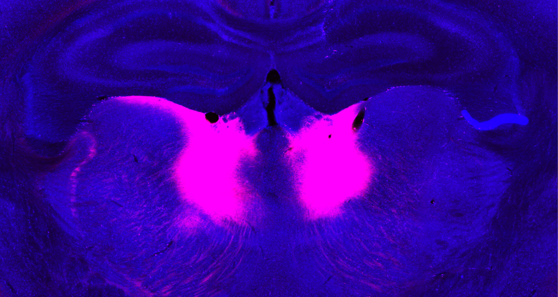 Brain circuit needed to incorporate new information may be linked to schizophrenia | MIT News