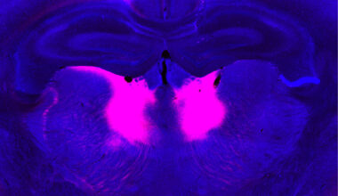Brain circuit needed to incorporate new information may be linked to schizophrenia | MIT News