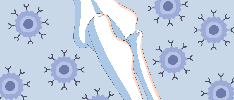 OSM CAR-T: Hope for Common Type of Bone Cancer