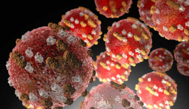 Washtenaw County reports fourth suspected measles case, lists exposure locations