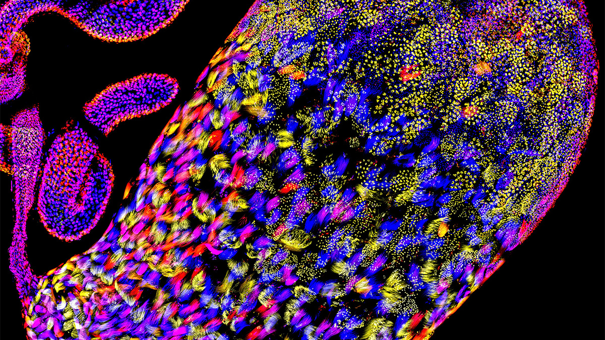 Selfish sperm hijack genetic gatekeeper to kill healthy rivals – @theU