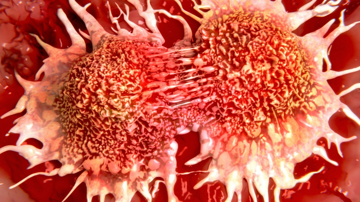New Experimental Drug Shrinks Tumors in Prostate Cancer Clinical Trial : ScienceAlert