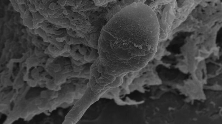 A close up of a sperm cell.