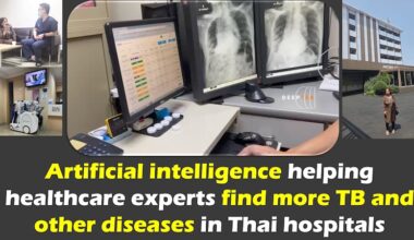 Artificial Intelligence Helping Healthcare Experts Find More TB And Other Diseases In Thai Hospitals – OpEd – Eurasia Review