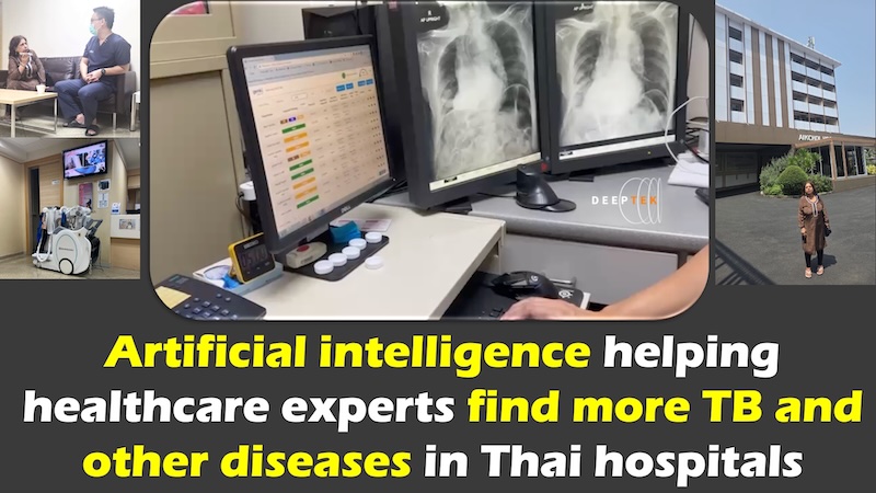 Artificial Intelligence Helping Healthcare Experts Find More TB And Other Diseases In Thai Hospitals – OpEd – Eurasia Review