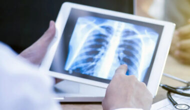 Harrow records highest rate of TB in London