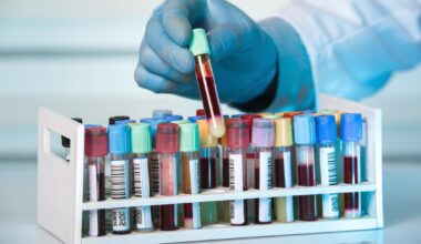 Test Identifies Active, Infectious Tuberculosis