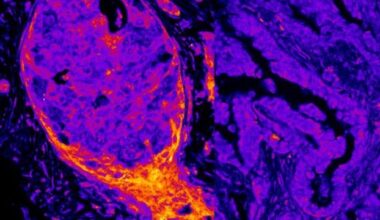 Metabolic Enzymes on Human DNA Reveal Nuclear Fingerprint