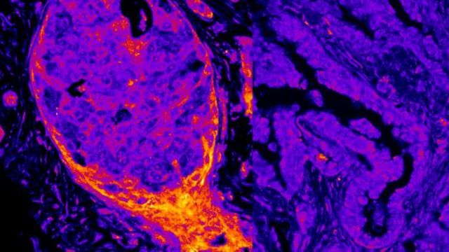 Metabolic Enzymes on Human DNA Reveal Nuclear Fingerprint