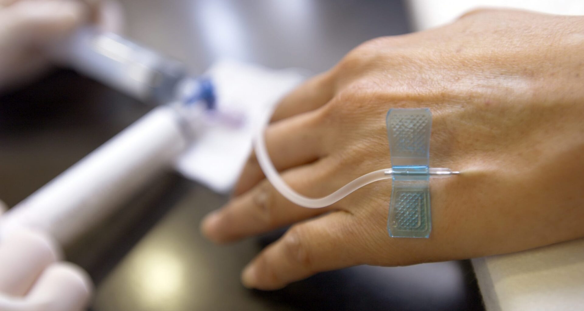 New AI Test Estimates Individualized Chemotherapy Benefit in Breast Cancer Patients