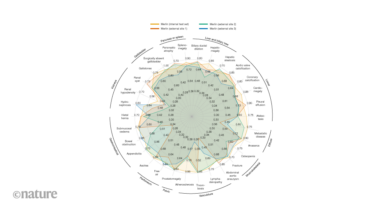 Radiology AI makes consistent diagnoses using 3D images from different health centres