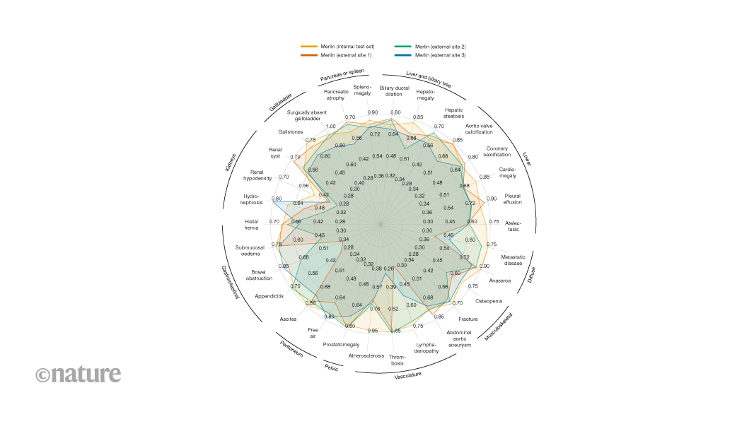Radiology AI makes consistent diagnoses using 3D images from different health centres