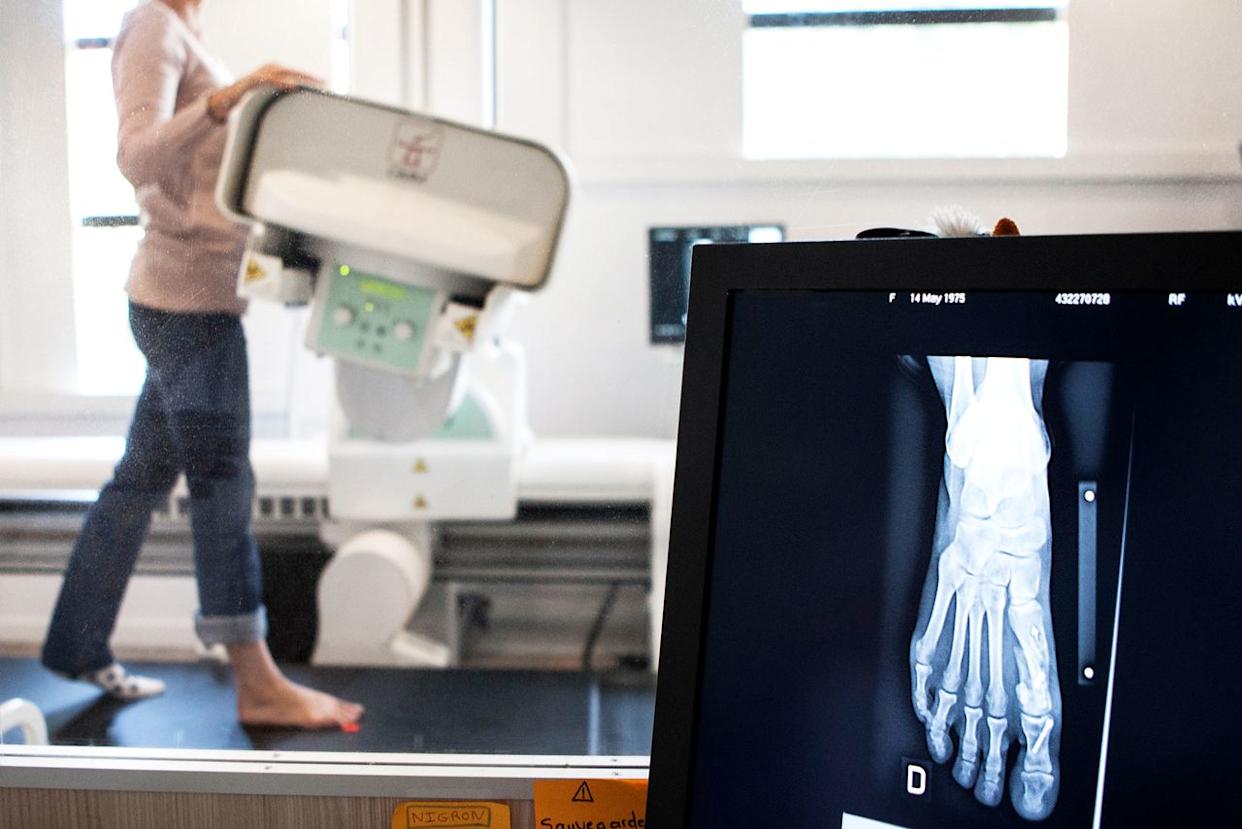 Stock image of someone getting a foot X-rayCredit: BSIP/Universal Images Group via Getty