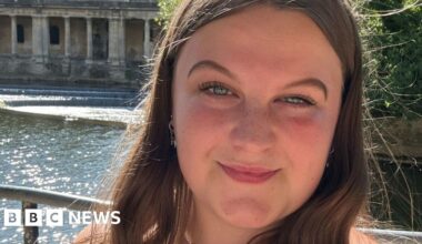 'Lucky to be alive' meningitis survivor shares warning - BBC