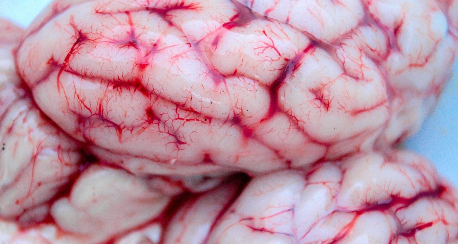 New map of fetal brain cell development helps pinpoint risk genes