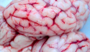 New map of fetal brain cell development helps pinpoint risk genes