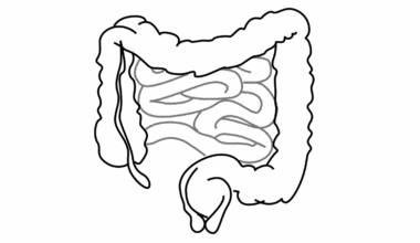 GLP-1 weight loss drugs include potential immune benefits in gut tissue