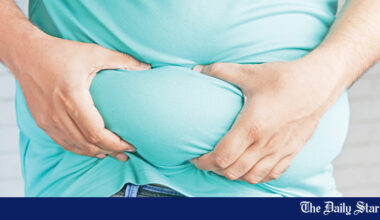 Study Findings: Obesity linked to higher risk of severe infections