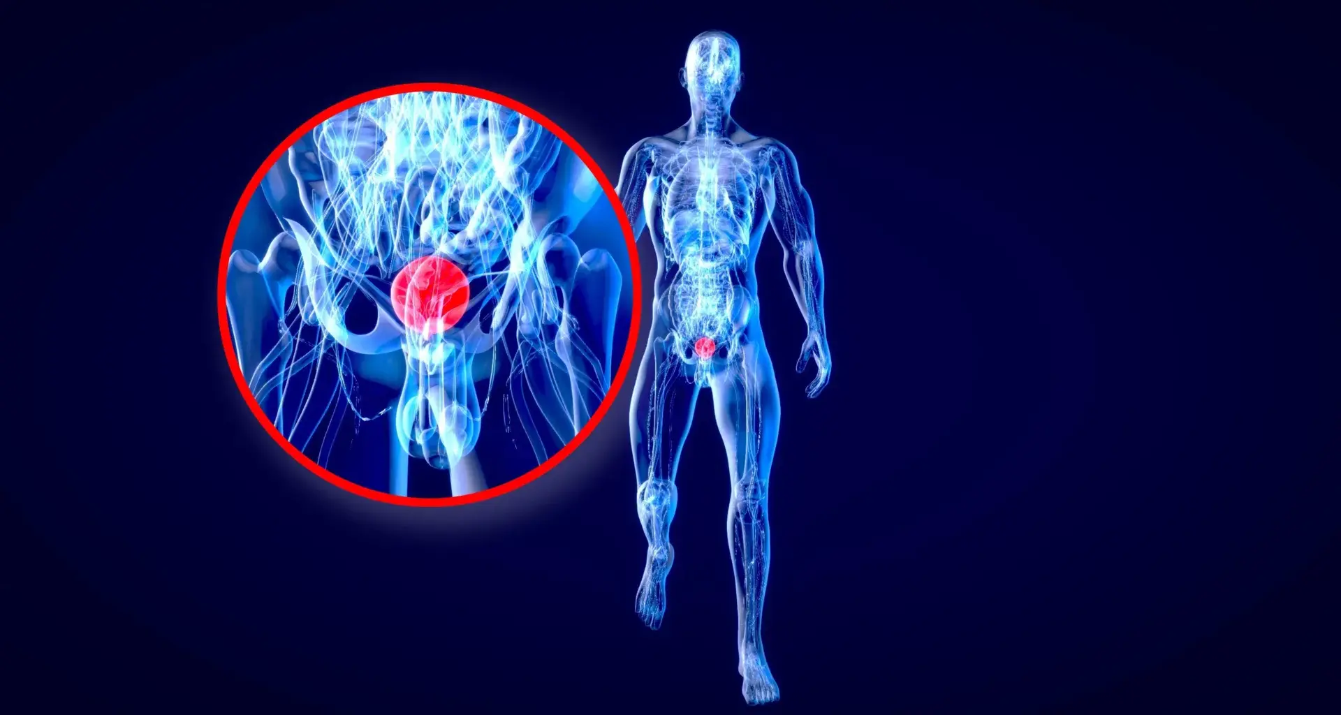 Stanford scientists say colorblindness may hide a deadly bladder cancer warning