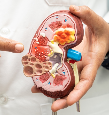 A person in a white lab coat holds a detailed anatomical model of a human kidney and points to it.