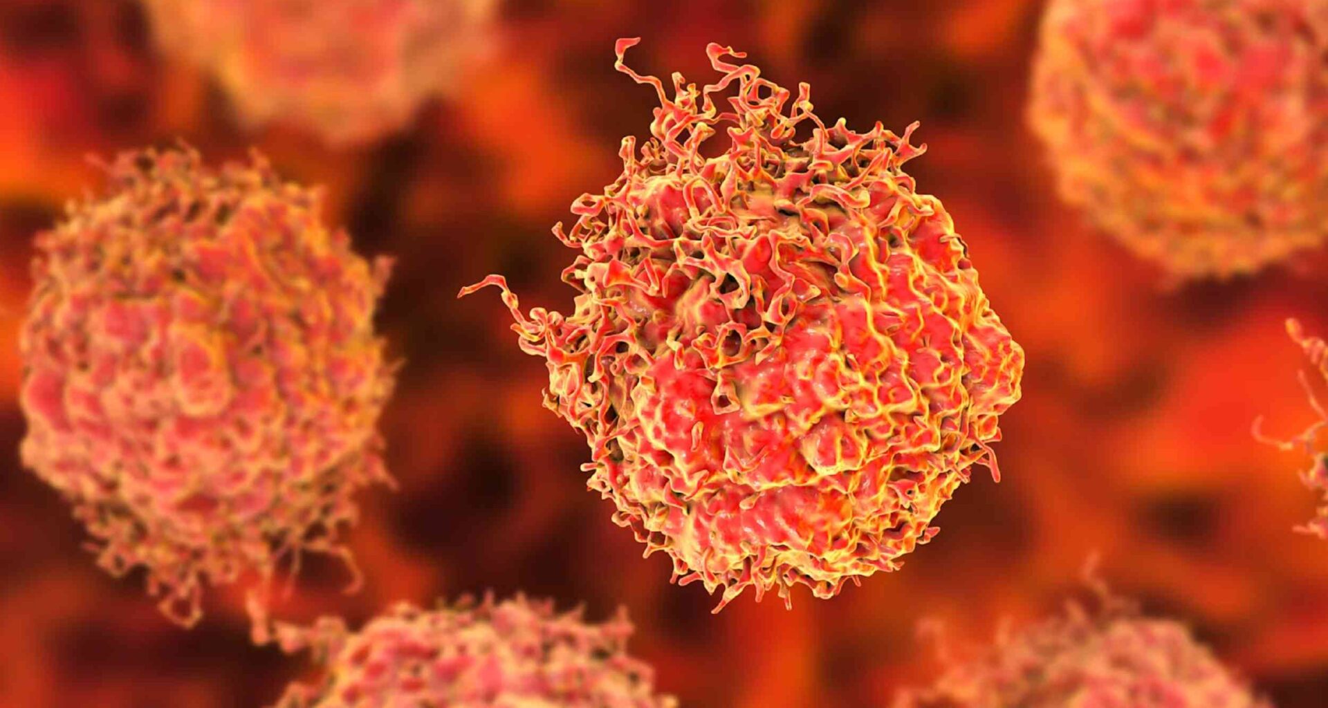 Low testosterone may signal high-risk prostate cancer