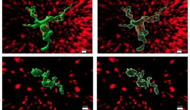 Immune Cells Play Role in Puberty Regulation