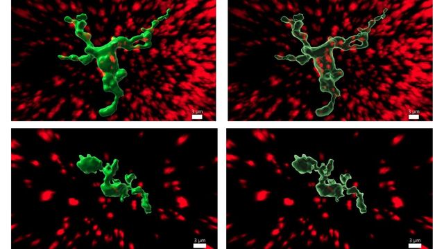 Immune Cells Play Role in Puberty Regulation