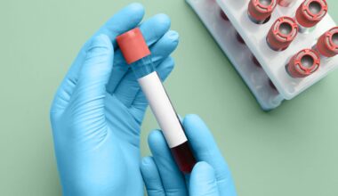 Blood Test May Predict Dementia in Women 25 Years Before Symptoms Appear