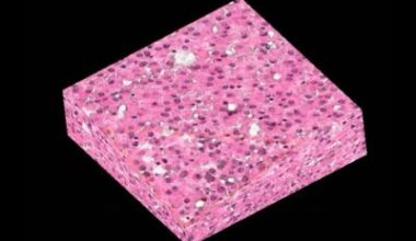 New X-ray technique could transform tissue diagnosis • healthcare-in-europe.com