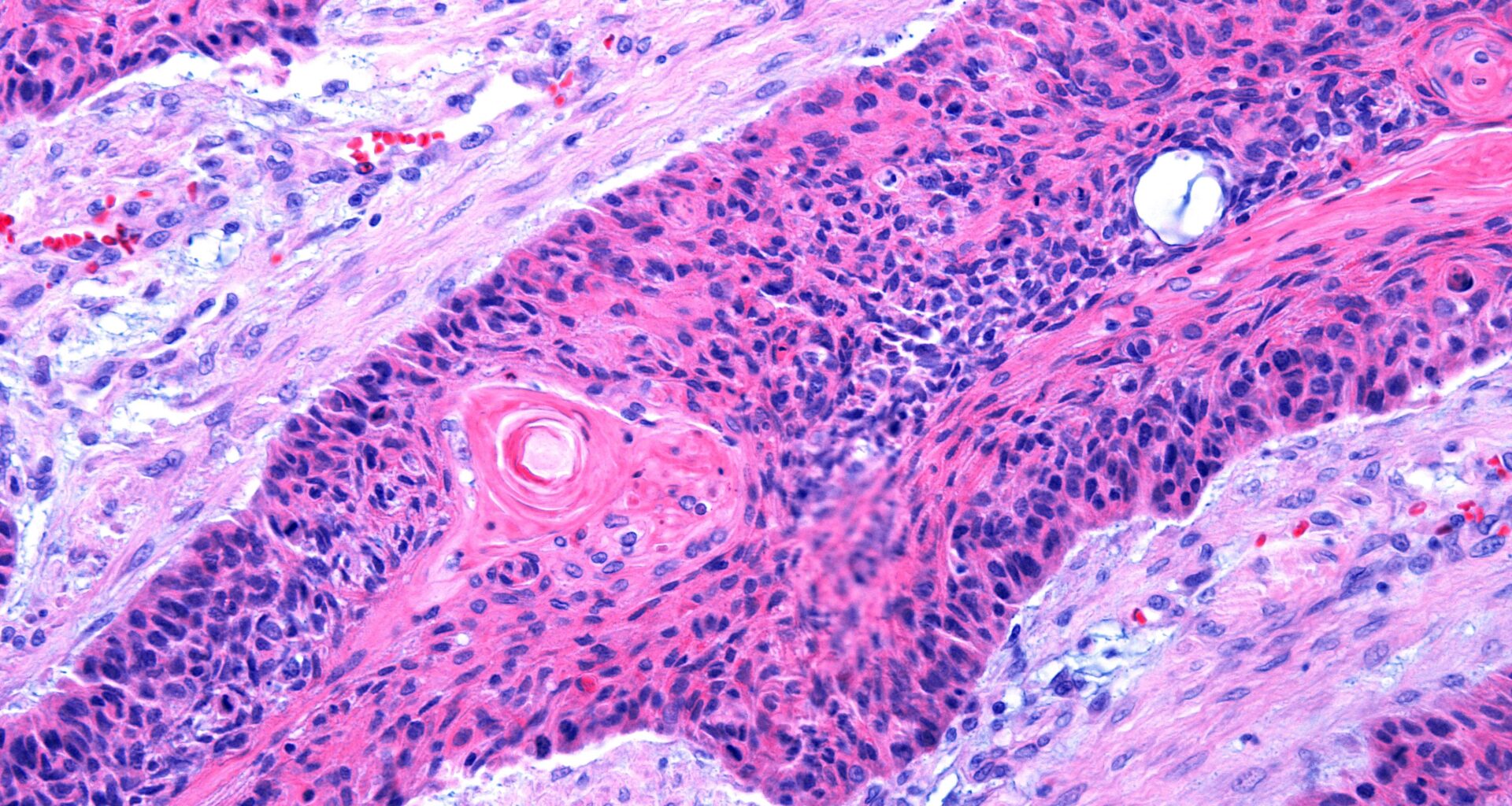 Scientists develop cream that triggers skin’s anti-cancer defence