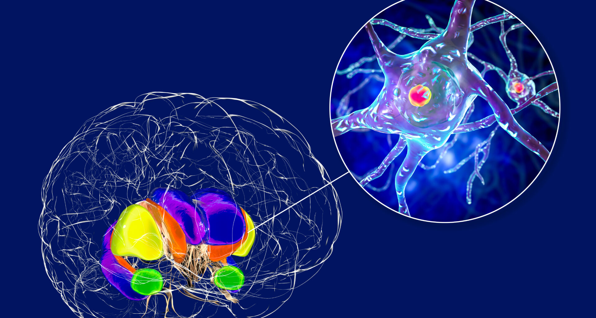 Blocking protein pathway may slow Huntington’s disease